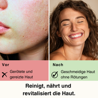 Vorher-Nachher-Bild zur Wirkung der Reinigungsmilch Energie mit Sanddornöl von Pure Elements. Links: gerötete und gereizte Haut vor der Anwendung. Rechts: geschmeidige, beruhigte Haut ohne Rötungen nach der Anwendung. Vorteil: Die Reinigungsmilch reinigt sanft, nährt intensiv und revitalisiert die Haut. Vegane Naturkosmetik mit echten Bergkristallen, glutenfrei, BDIH-zertifiziert, tierversuchsfrei und Made in Germany