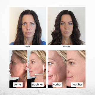 Das Bild zeigt drei Frauen im Vorher-Nachher-Vergleich – jeweils unterteilt in zwei Ansichten. Die Nachher-Bilder zeigen sichtbar straffere, glattere und strahlendere Haut mit weniger Falten, Augenringen und einem gesunden Teint. Die Ergebnisse stammen aus der Anwendung der Pure Elements Anti-Aging Pflege mit Lotusextrakt – vegane Naturkosmetik mit echten Bergkristallen, glutenfrei, tierversuchsfrei, BDIH-zertifiziert, Made in Germany